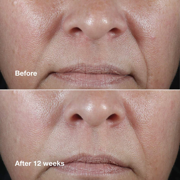 کرم ضدچروک کلینیک Smart Clinical Repair حجم ۵۰ میلیلیتر
